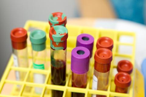 biology test tubes filled with blood